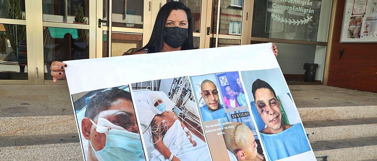 Lupe Comesaña, madre del joven agredido en Nigrán, Nacho, con las fotos de sus lesiones.   | // ANXO GUTIÉRREZ