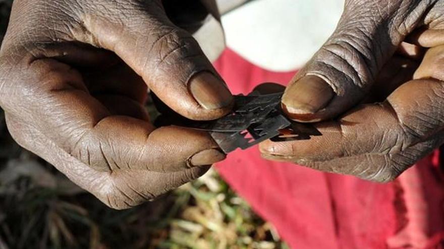 Se suelen utilizar cuchillas o utensilios domésticos.