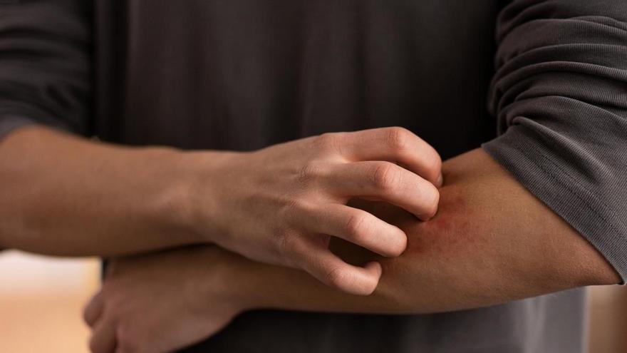 España, clave en la lucha contra el Chagas, la 