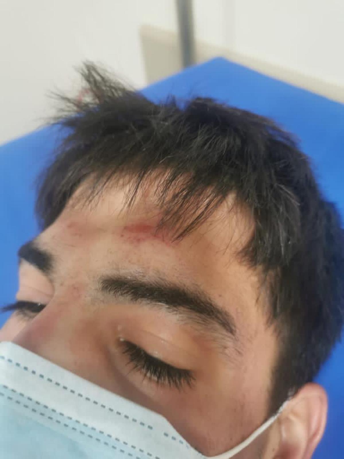 Kevin muestra sus heridas tras la trifulca Kevin muestra sus heridas tras la trifulca