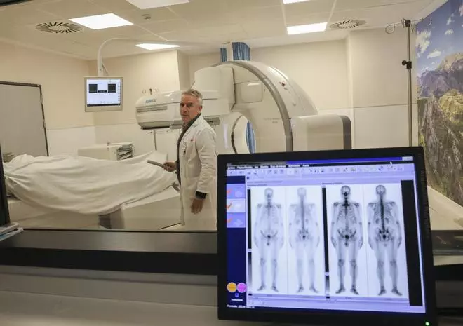 Cámaras gamma de última generación y radiofármacos para diagnosticar más rápido los tumores óseos