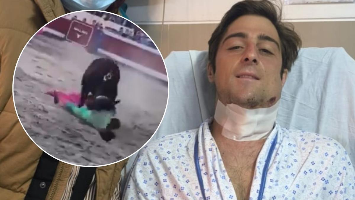 Jordi Pérez 'El Niño de las Monjas' tras ser operado de la garganta en Perú.