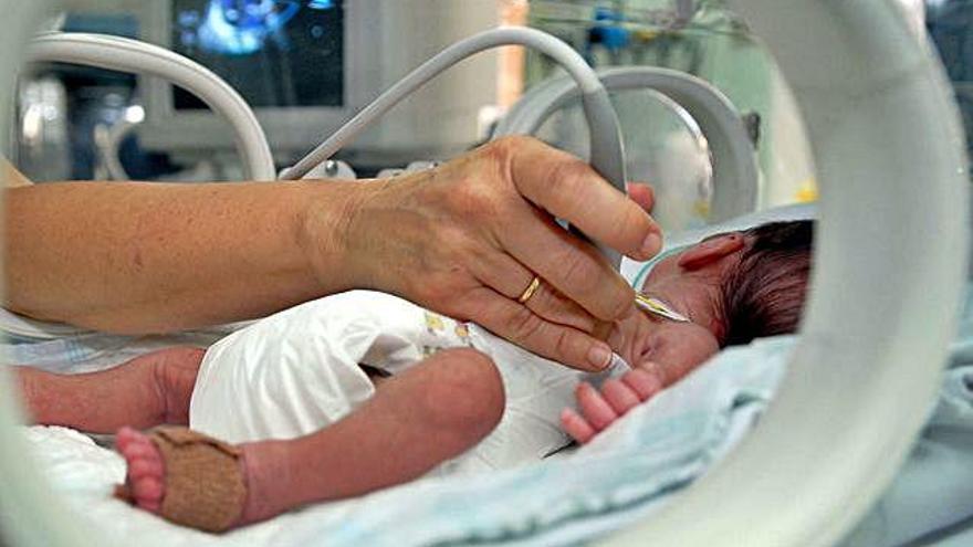 Un bebé atendido en la unidad de neonatos del Hospital Materno Infantil de la capital grancanaria.