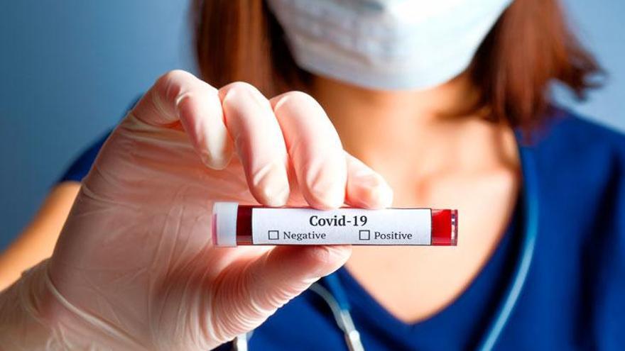 COVID19: la importancia de conocer la inmunidad frente al coronavirus