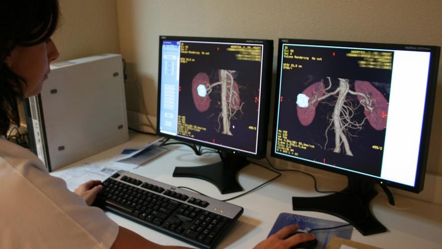 Llíria baja el ritmo de los TAC y mamografías por falta de técnicos
