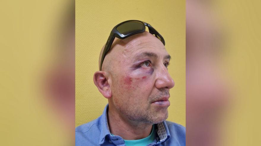 La víctima, minutos después de la agresión.