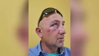 Una brutal agresión de un okupa fractura la mandíbula a un vecino en Carcaixent