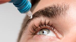 Una paciente aplicándose un colirio en el ojo