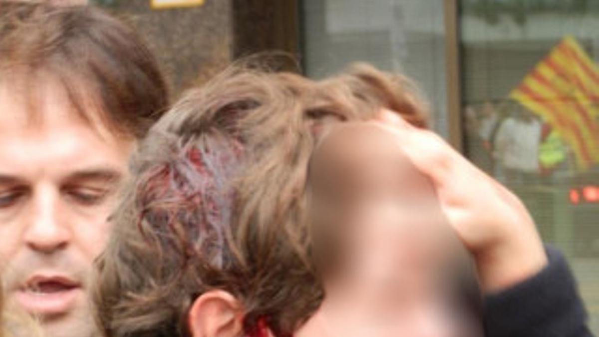 Un niño de 13 años sangra tras ser golpeado por un 'mosso'