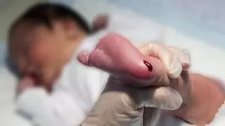 El cribado neonatal topa con la desigualdad territorial: Murcia detecta 44 patologías en la prueba del talón y Asturias solo 11