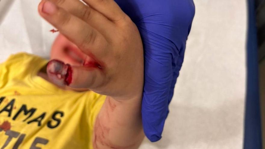 El dedo de un niño de tres años queda atrapado en la bisagra de una puerta en un colegio de Torrevieja