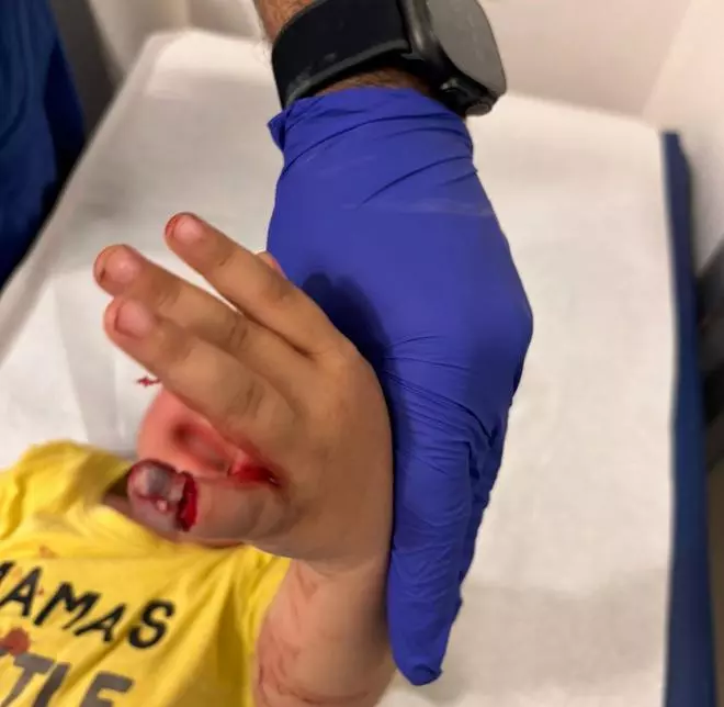 El dedo de un niño de tres años queda atrapado en la bisagra de una puerta en un colegio de Torrevieja