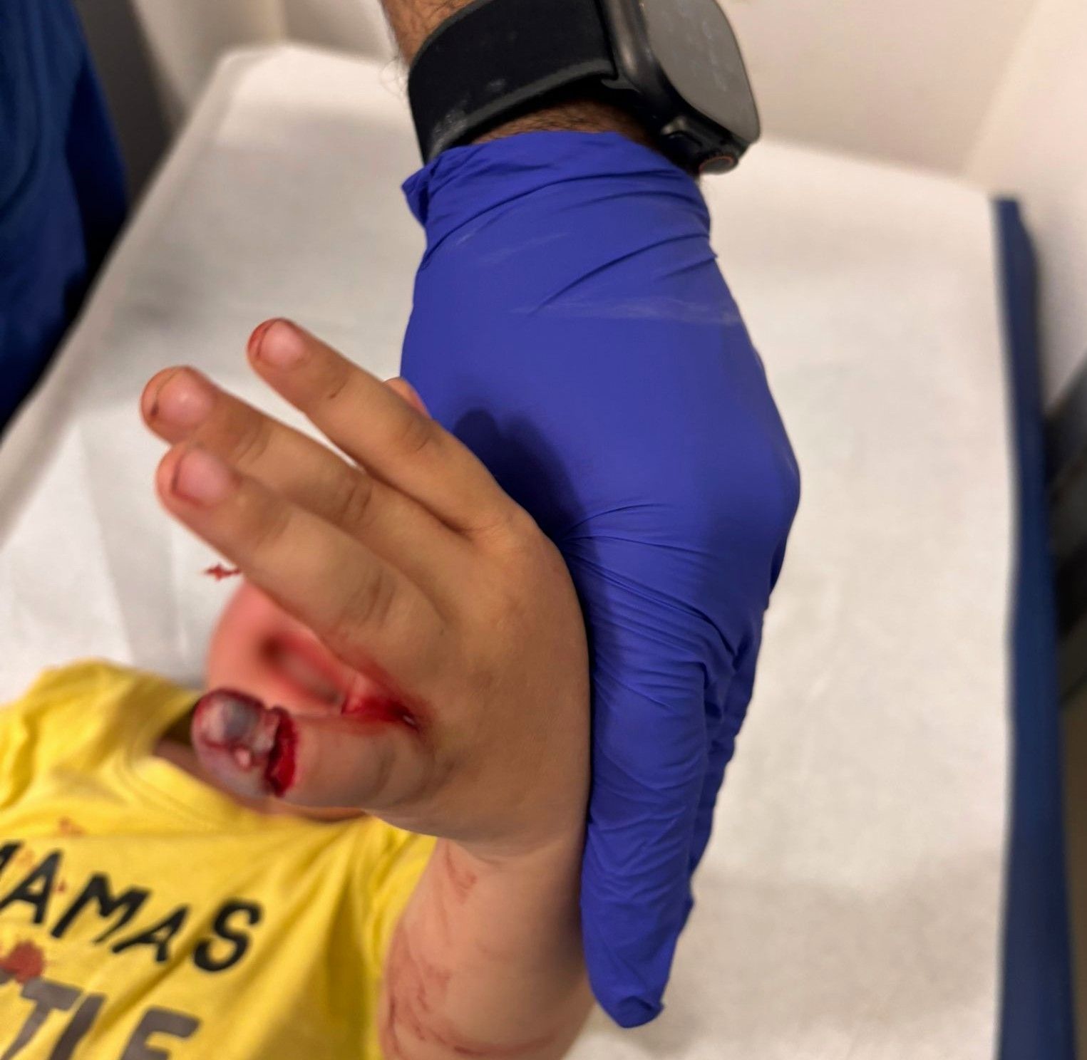 El menor sufrió una herida profunda del dedo meñique de la mano izquierda.