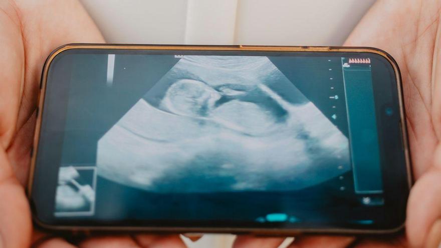 Los microplásticos pueden atravesar la placenta y alterar las hormonas del embarazo