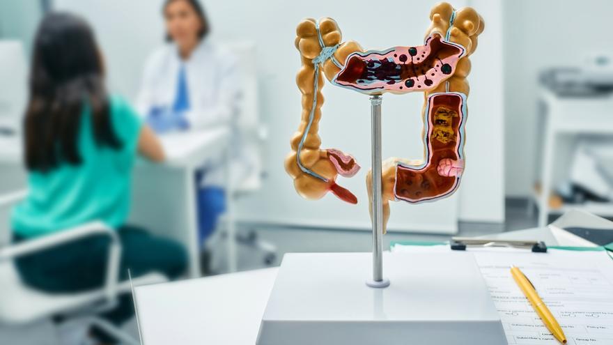 Día Mundial del Cáncer de Colon: un diagnóstico a tiempo puede salvar vidas