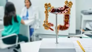 El médico Fernando Fabiani, sobre cómo prevenir el cáncer de colon: "Si actuamos podemos disminuir el riesgo"
