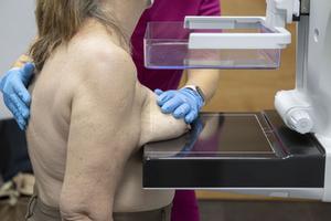 Una enfermera realiza una mamografía a una mujer. EFE/ Marcial Guillén