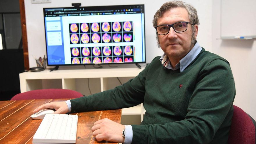 Daniel Fernández Mosquera, en la sede de Qubiotech con imágenes de áreas cerebrales. | // CARLOS PARDELLAS