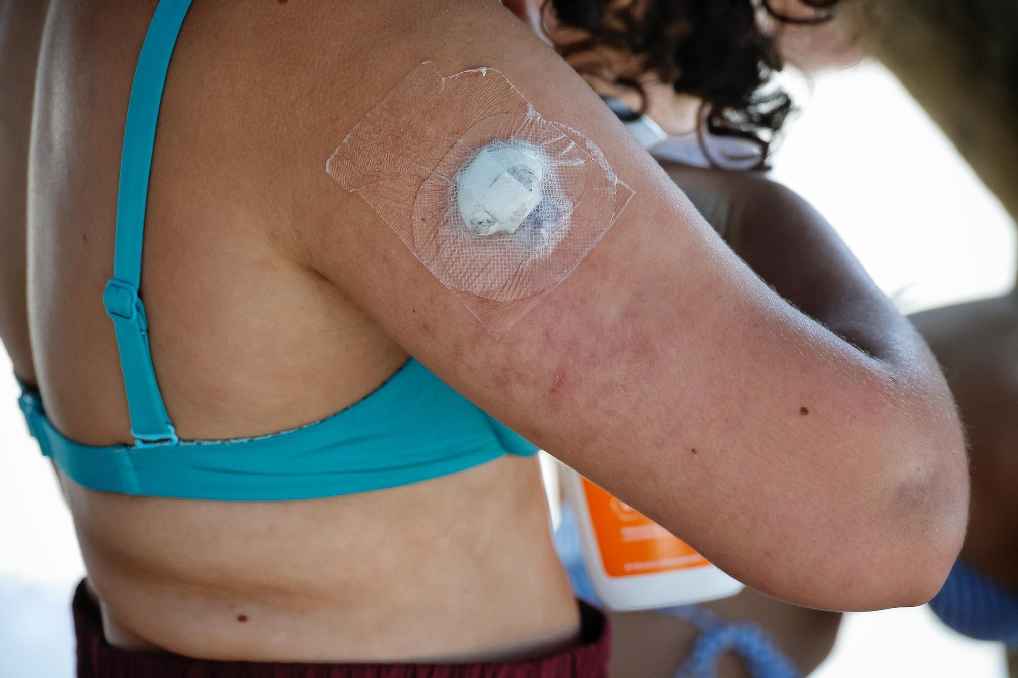 Adolescentes con diabetes disfrutan del verano en la Playa de Las Teresitas