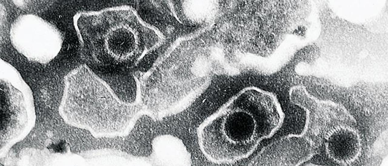 Tres partículas del virus de Epstein-Barr, con forma circular, vistas al microscopio electrónico. |   // LIZA GROSS