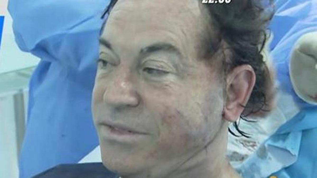 Pipi Estrada durante la operación.