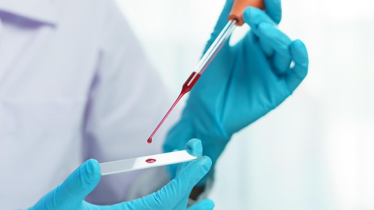 Análisis de una muestra de sangre en un laboratorio