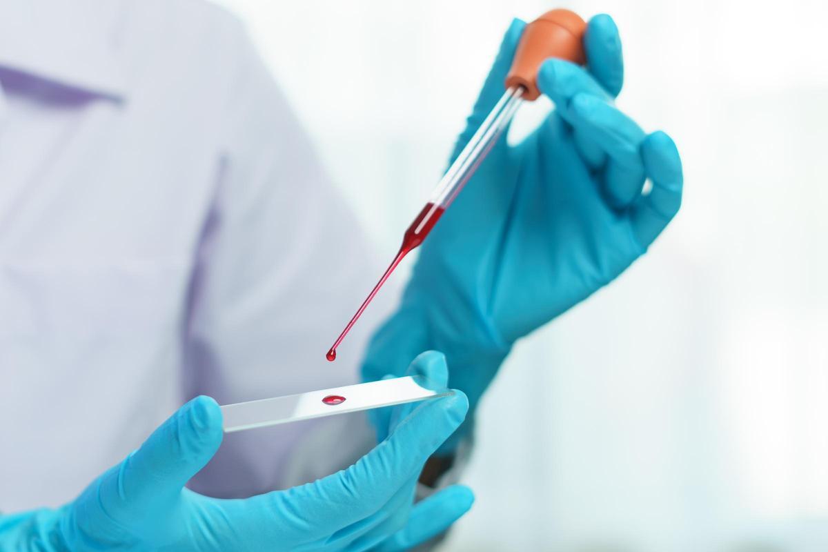 Una muestra de sangre.