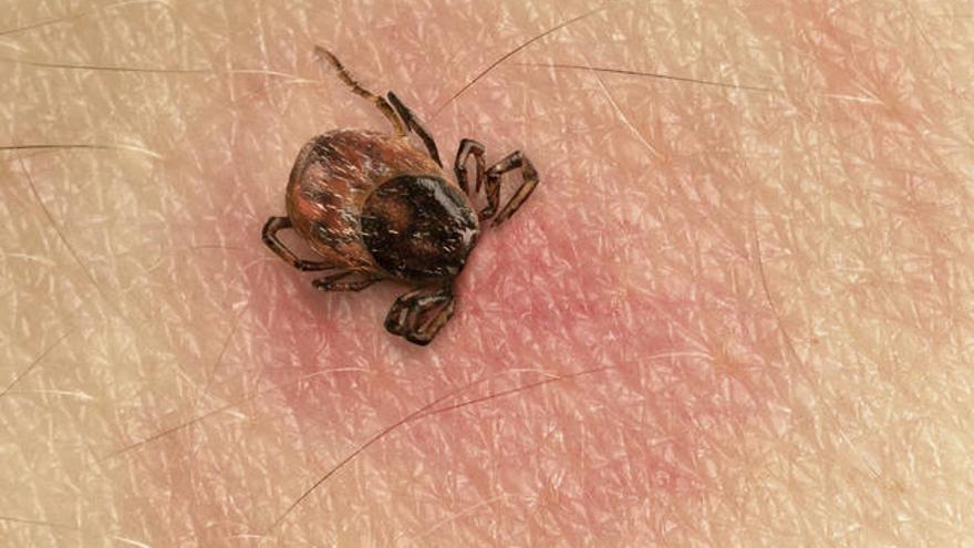 Enfermedad de Lyme: síntomas y consejos para prevenirla