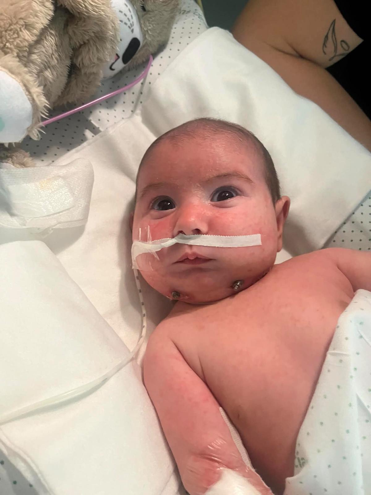 Aitana con un mes tras la intervención.