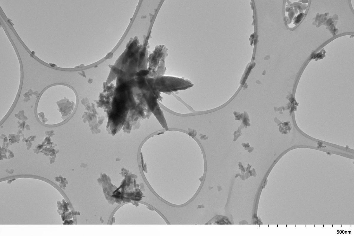 Nanoplásticos adheridos a las arterias carótidas