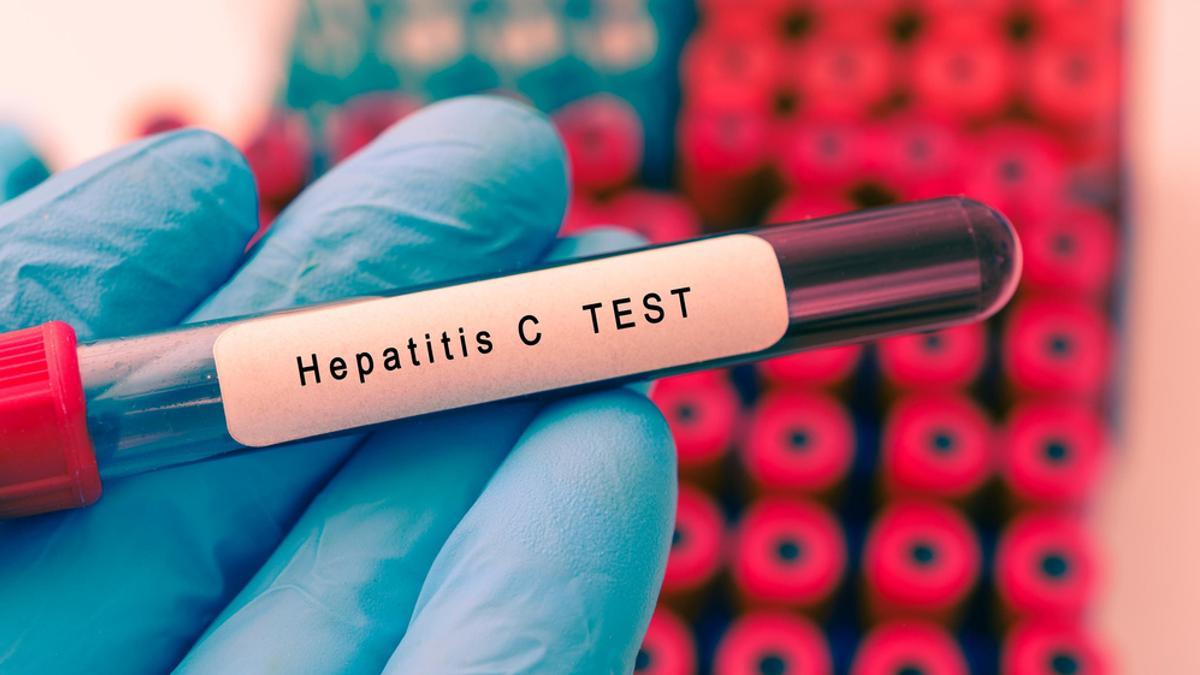 Resultado de una prueba de Hepatitis C.
