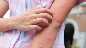 Este animal es el que tiene la peor picadura.