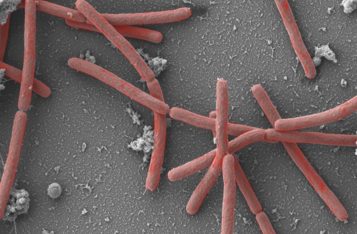 Arqueas methanothermobacterias vistas con un microscopio electrónico.