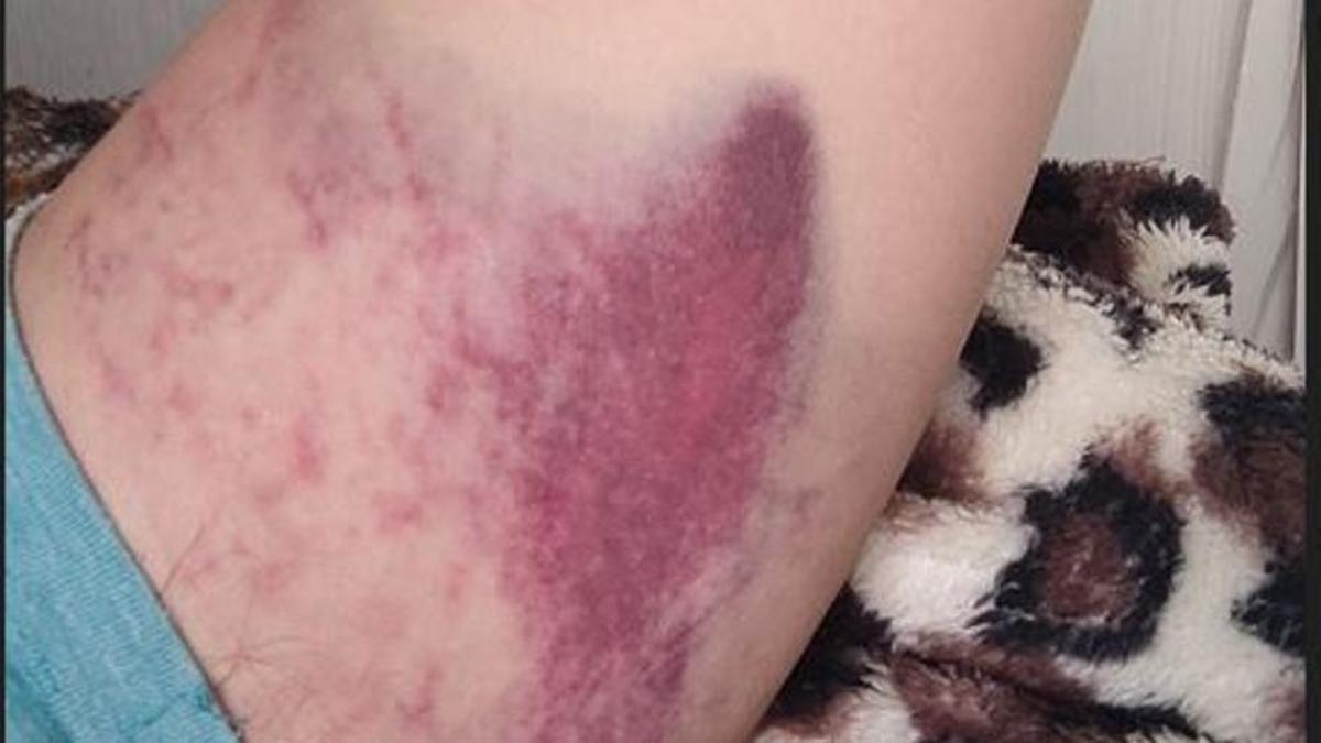 Un jove denuncia una agressió homòfoba en mans de sis persones a València: «Maricon, monstre, no hauries d’haver nascut»