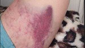 Un jove denuncia una agressió homòfoba en mans de sis persones a València: «Maricon, monstre, no hauries d’haver nascut»