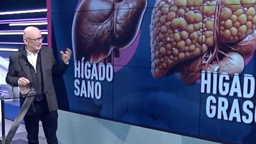 Antonio Linares, médico digestólogo: &quot;El hígado graso ni duele ni produce ningún síntoma incluso cuando ya hay complicaciones&quot;