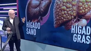 Antonio Linares, médico digestólogo: "El hígado graso ni duele ni produce ningún síntoma incluso cuando ya hay complicaciones"