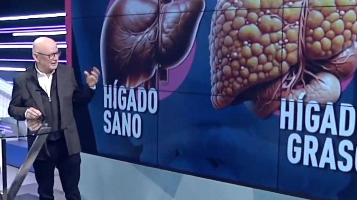 Antonio Linares, médico digestólogo El hígado graso ni duele ni produce ningún síntoma incluso cuando ya hay complicaciones