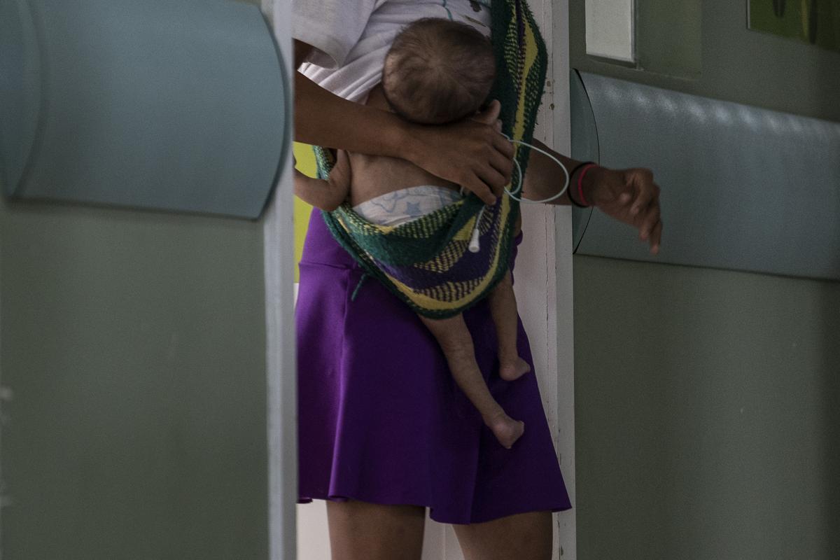 Niño indígenas yanomami desnutridos reciben tratamiento en el Hospital Infantil Santo Antonio en Boa Vista, estado de Roraima, Brasil.