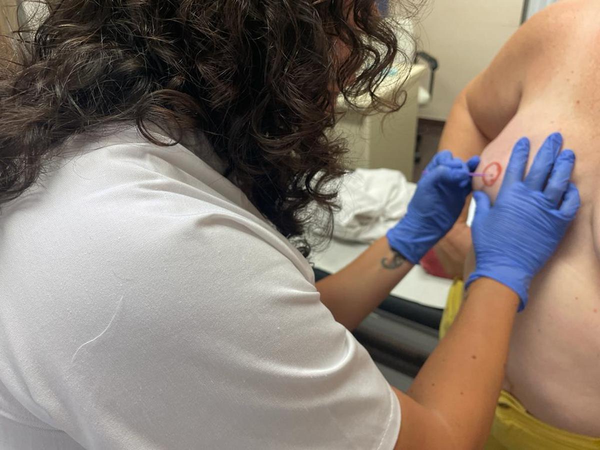 Dibujo de la areola de una paciente operada de cáncer de mama en el Hospital de Sant Joan. La reconstrucción se hace previamente en el Hospital de Alicante