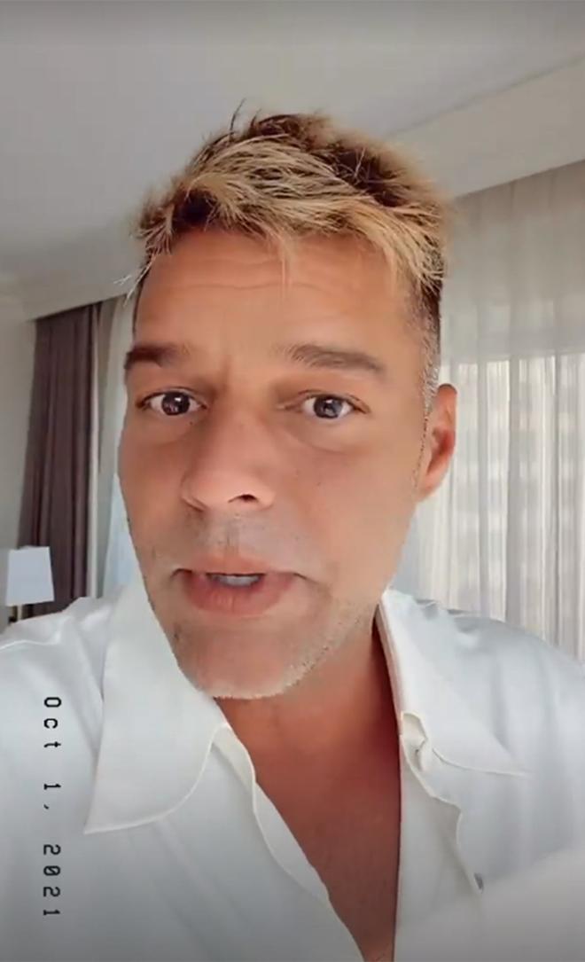 Ricky Martin habla sobre su cara