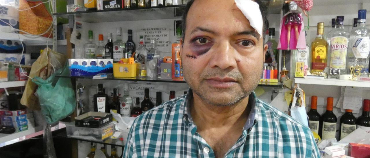 Amarjit Singh, després de l&#039;agressió rebuda al supermercat durant un robatori