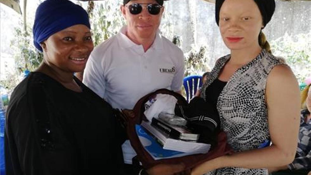 Guinea se convierte en el primer país del mundo en aprobar una ley específica para la promoción y protección de los albinos.