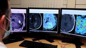 Imágenes de resonancia magnética de cerebro en el Hospital Universitari de Bellvitge (HUB), que ha colaborado con los investigadores del Vall dHebron Institut dOncologia (VHIO)