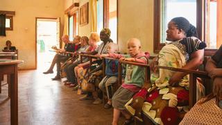 Tres alumnas de la USC optan a un premio por un proyecto con albinos en Mozambique