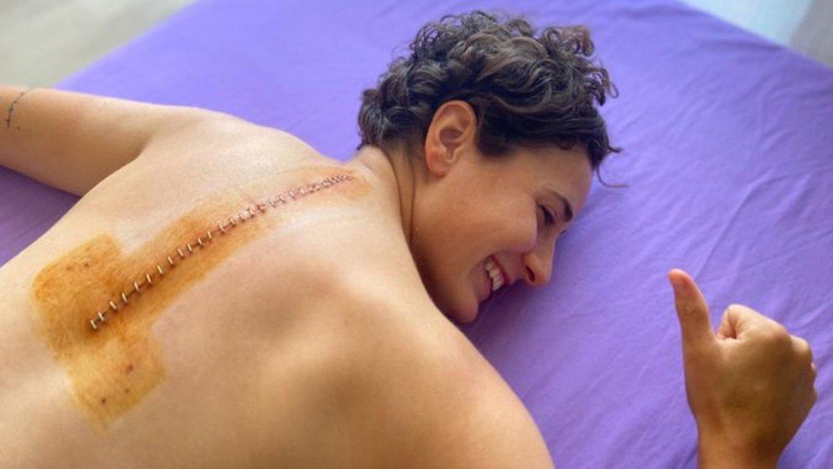 Ana Carrasco muestra cómo ha quedado su espalda tras su última operación