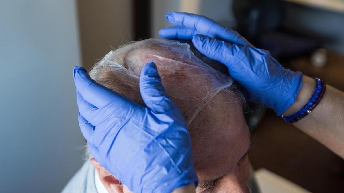Seguimiento a pacientes con un alto riesgo de sufrir cancer de piel