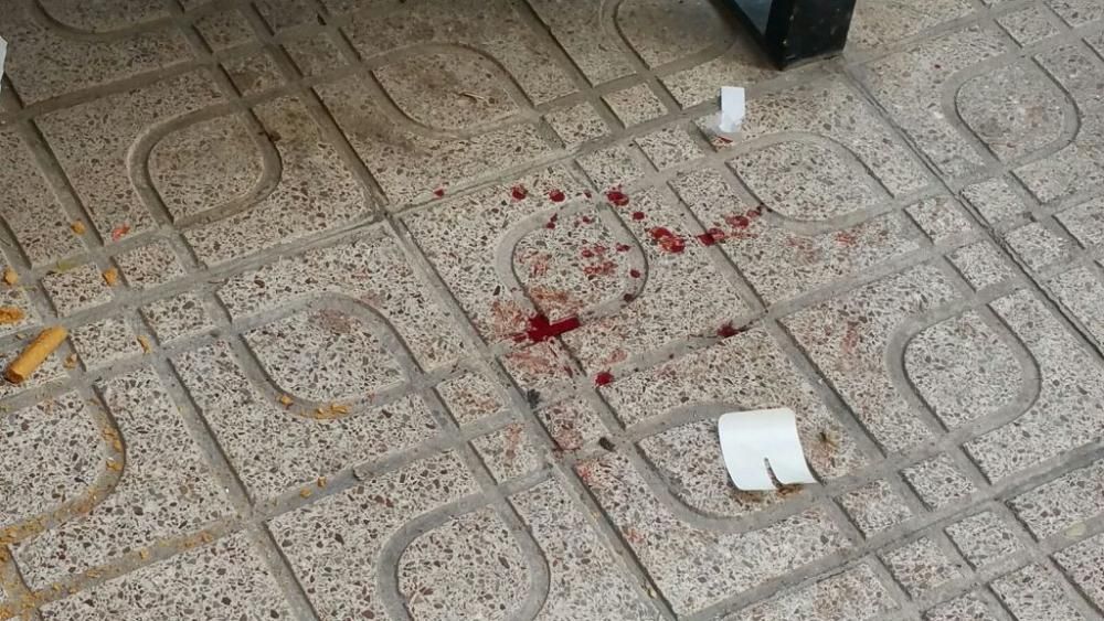 Tres heridos tras una explosión en la plaza de abastos de Lorca