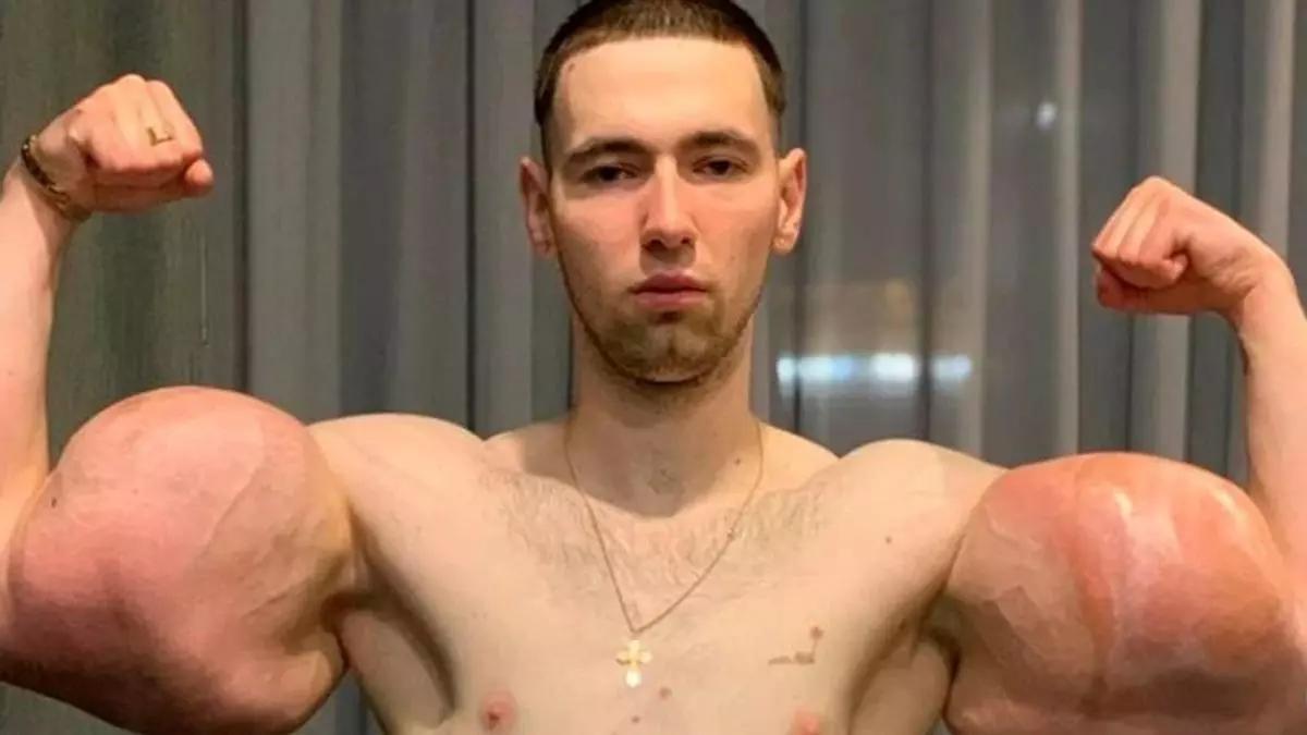 El luchador y fisicoculturista Kirill Tereshin atraviesa el peor momento de su vida