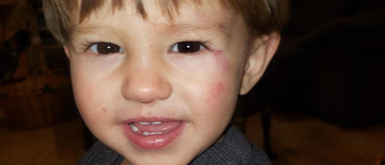 El niño herido en un accidente en un parque infantil de Plasencia.